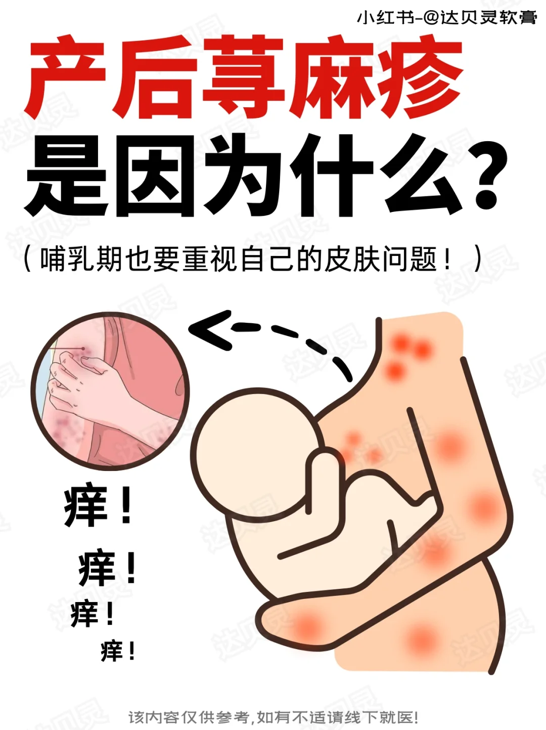 产后皮肤困扰：解析荨麻疹成因与应对策略